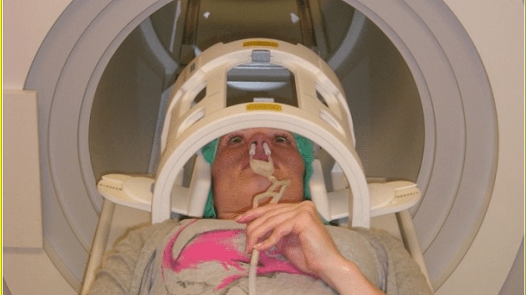 A person undergoing an MRI brain scan, illustrating neuroimaging research on the brains of transgender people.
