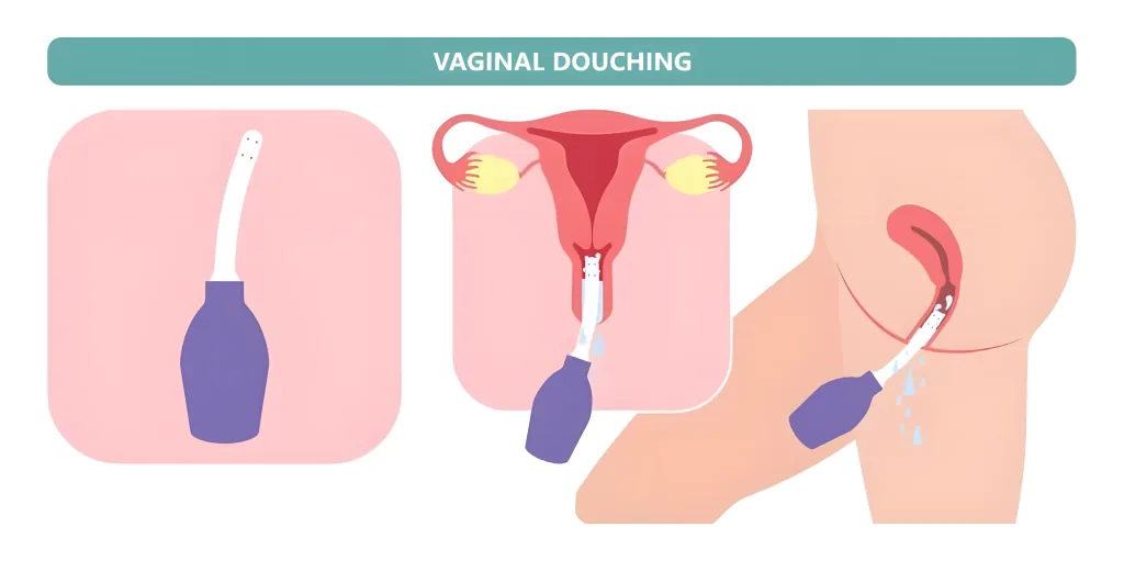 An informational graphic explaining why douching is unnecessary and harmful to vaginal health.
