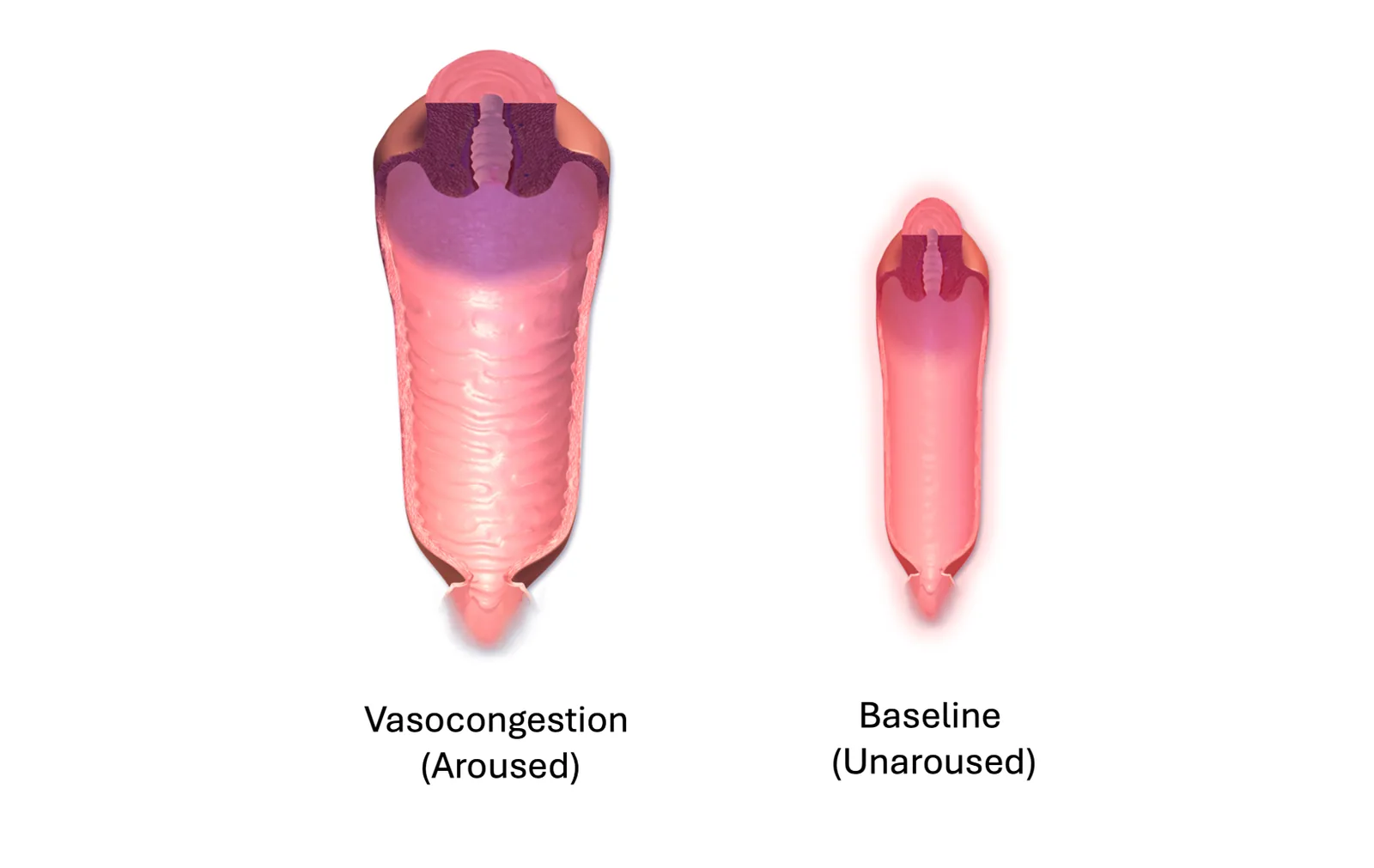 A diagram comparing the vagina at rest and during arousal, showing how vasocongestion causes the tissues to engorge and the canal to expand.