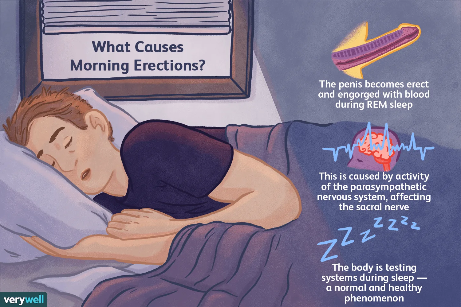 A diagram of a sleep cycle showing REM phases highlighted, with an icon indicating that erections typically occur during these phases throughout the night.