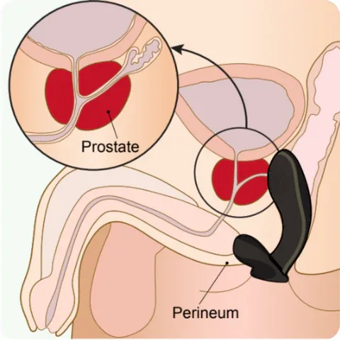 A cross-sectional diagram showing the location of the prostate gland, demonstrating how it can be reached for prostate massage through the anterior rectal wall.