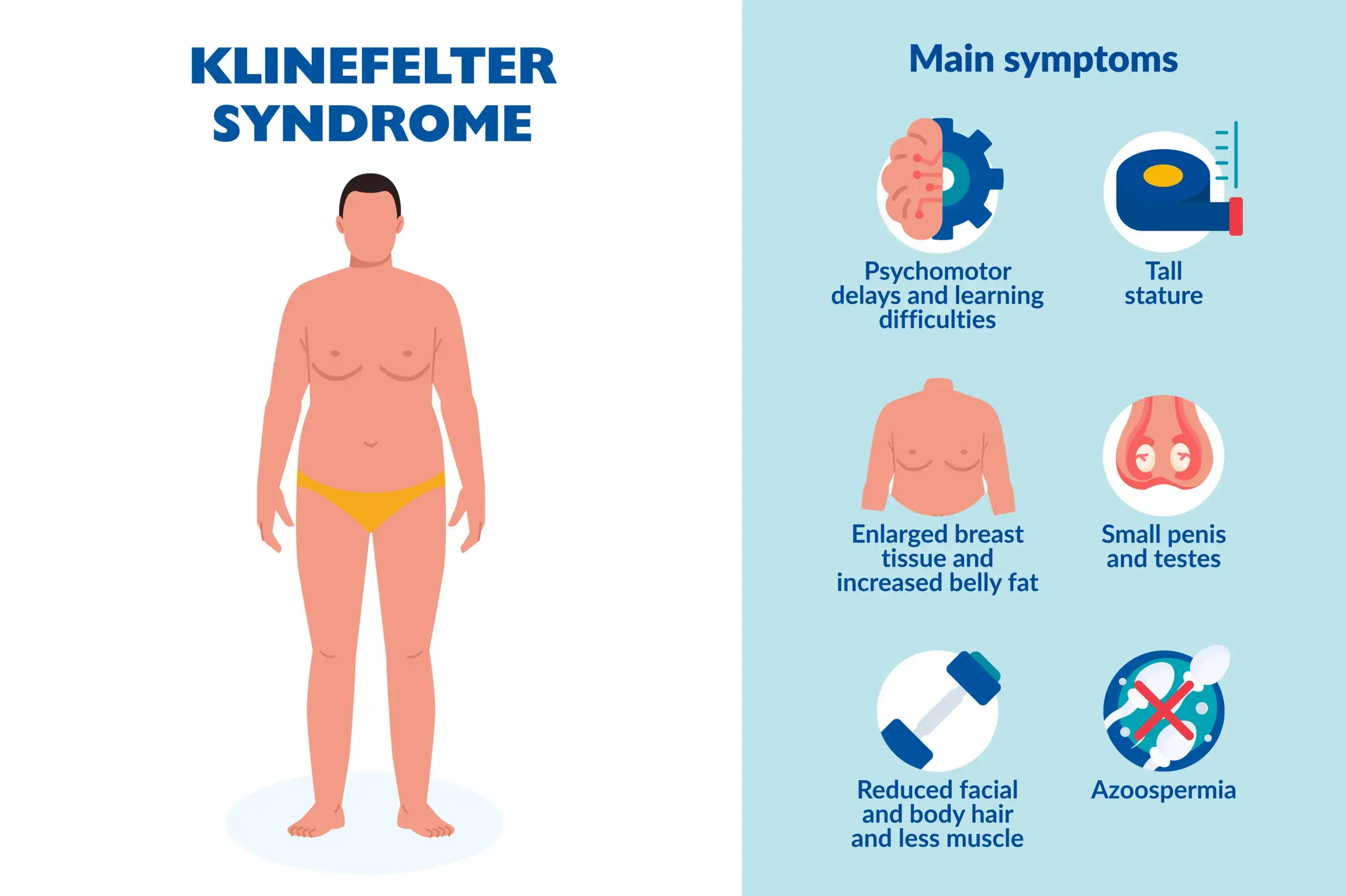 A medical illustration depicting the characteristic features of Klinefelter syndrome (XXY).