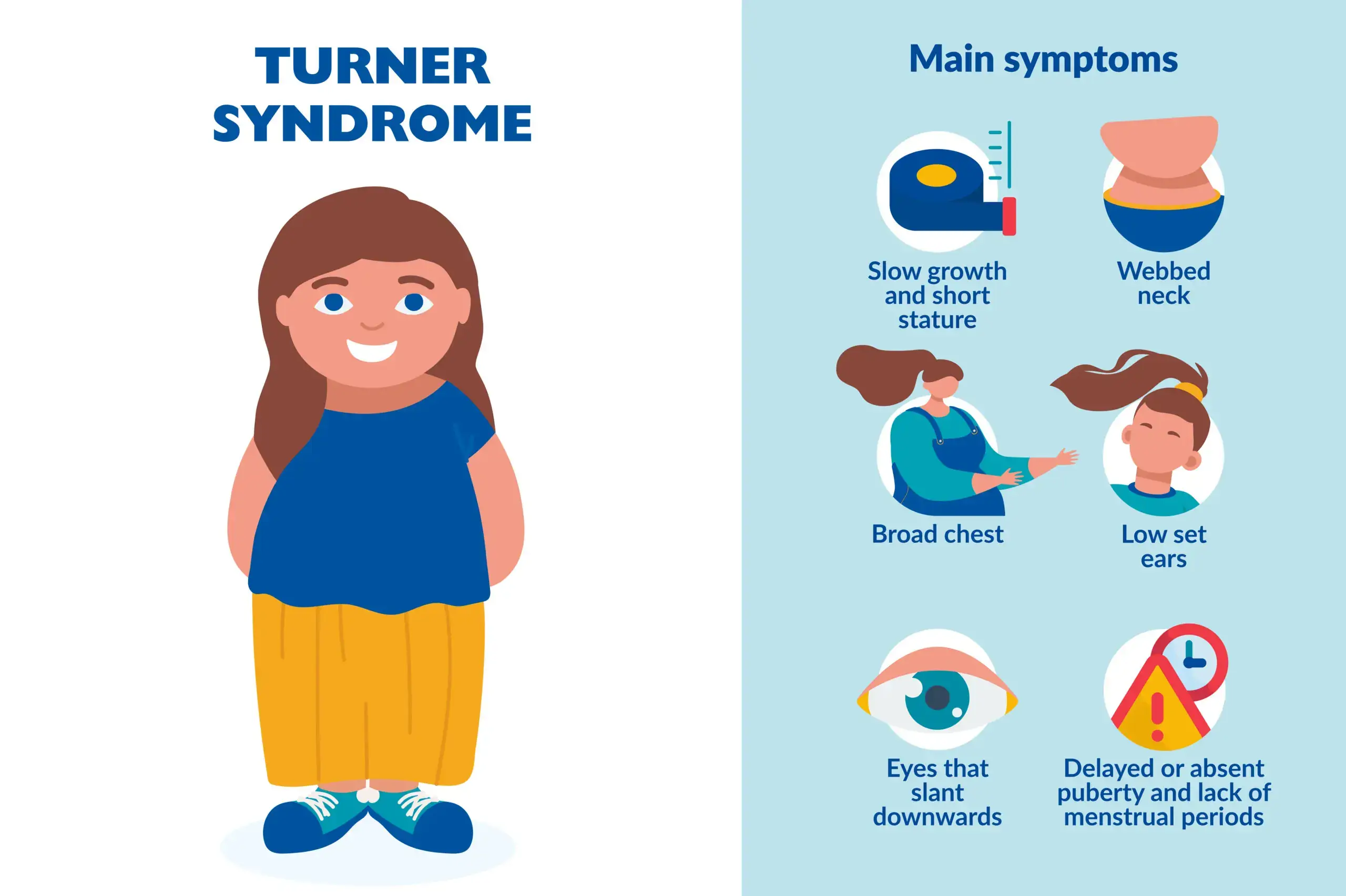 A medical illustration depicting the characteristic features of Turner syndrome (XO).