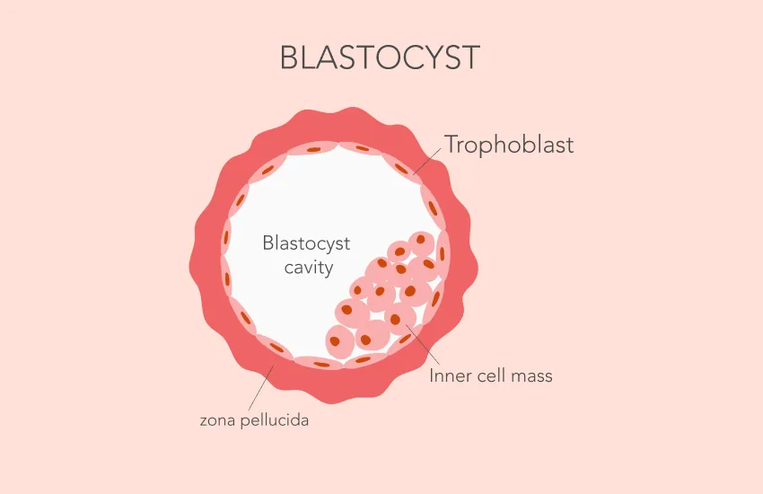 Diagram of a blastocyst showing the outer cell layer that becomes the placenta and the inner cell mass that becomes the embryo.