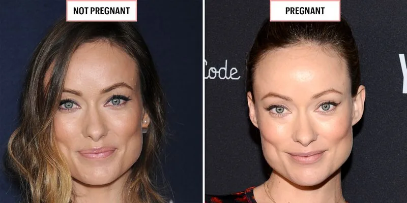 A pregnant person with the warm, flushed complexion known as the pregnancy glow.