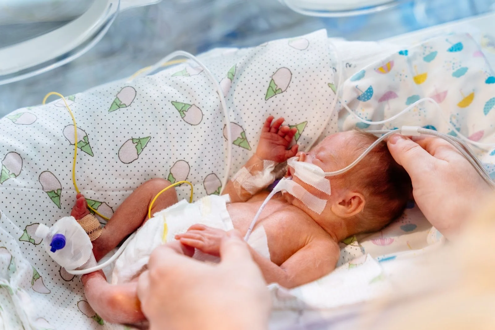 A premature newborn receiving care in a neonatal intensive care unit.