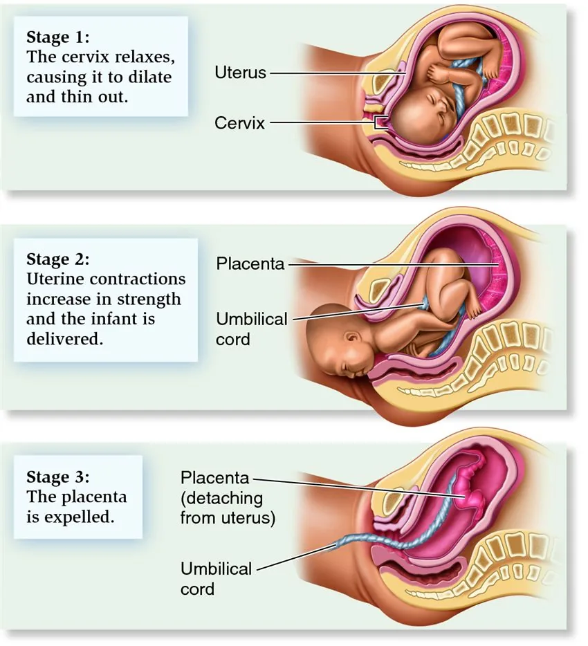Diagram showing the cervix dilating and the baby descending through the stages of labor.