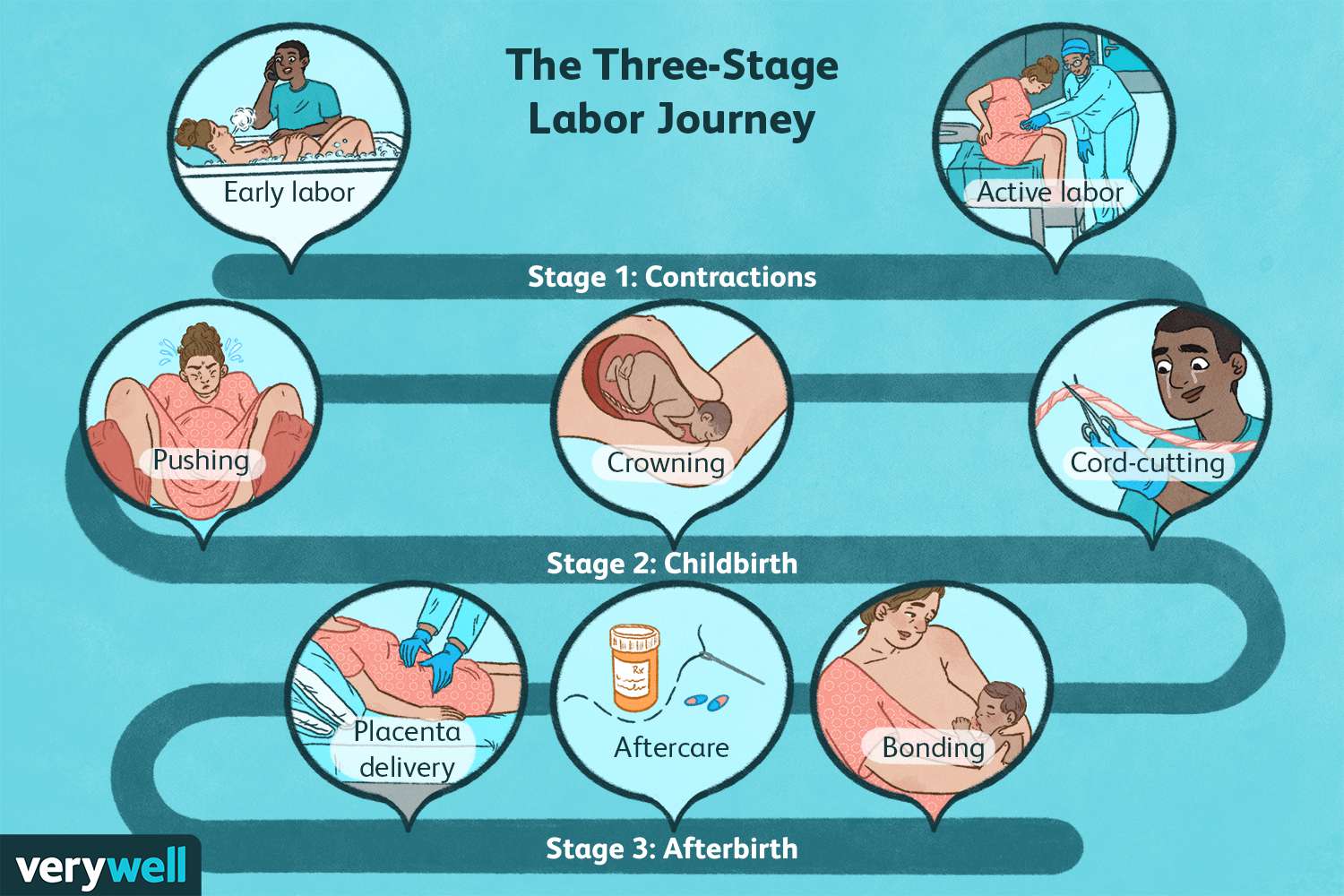 Diagram of the three stages of labor: cervical dilation, delivery of the baby, and delivery of the placenta.