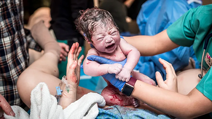 A newborn immediately after a vaginal birth.