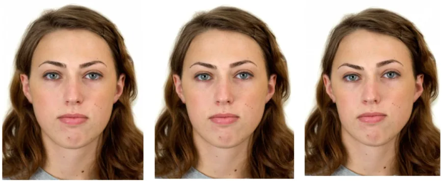 A chart from a facial-symmetry experiment showing that noticeably asymmetrical faces are rated far lower in attractiveness than moderately or perfectly symmetrical faces.