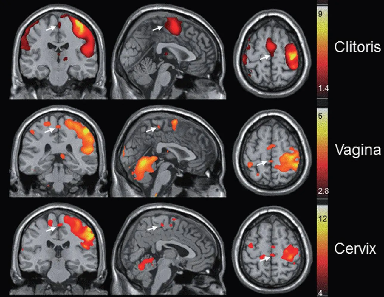fMRI brain scans mapping activation from clitoral, vaginal, and cervical stimulation.