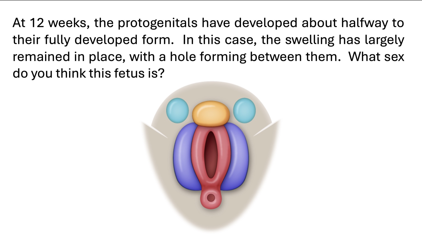 At 12 weeks, the protogenitals have developed about halfway to their fully developed form. In this case, the swelling has largely remained in place, with a hole forming between them. What sex do you think this fetus is?